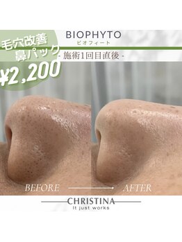 ザ サロン シーア 錦糸町(THE SALON thea)/《鼻の毛穴》ハーブピーリング