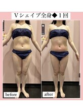 ルピナス ヒサヤ(LUPINUS hisaya)/Ｖシェイプ痩身