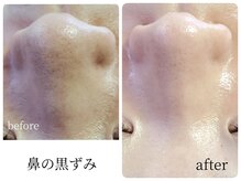 陶器のような肌ですっぴん綺麗を目指すサロンです