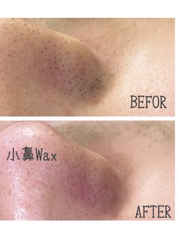 メンズプシュケ(men's PSYCHE)/小鼻WAX