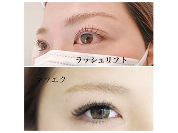 アレーズ(alaise)