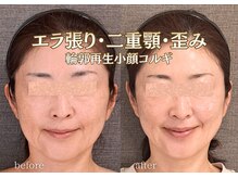 バンブー(bamboo)