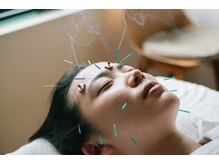 シー 中目黒(she)/お顔へのお灸