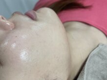 トゥウィーサロン 梅田(Tweesalon)/ツヤ肌フェイシャルワックス