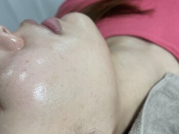 トゥウィーサロン 梅田(Tweesalon)/ツヤ肌フェイシャルワックス