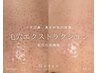 【再来】いちご鼻・毛穴の詰まり★毛穴エクストラクション60分　通常14300
