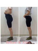 スタイルラボ高松/産後骨盤矯正の効果♪