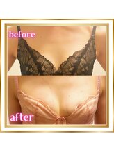 ジュエルリング(Jewel Ring)/バストアップ【恵比寿代官山】