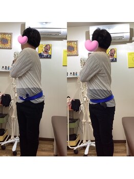 ヒデ整体院(Hide整体院)/猫背矯正骨盤矯正B/A肩こり腰痛