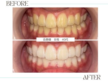 ホワイトニングサロンブライト 尼崎店(Whitening salon bright)/セルフホワイトニング 女性