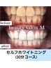 ★通常コース★セルフホワイトニング30分照射
