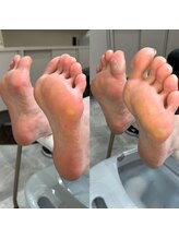 ティディーネスト(Tidynest)/■オプション/かかとケア■