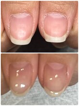 シュガーズネイル(sugar's nail)/ジェルで自爪育成