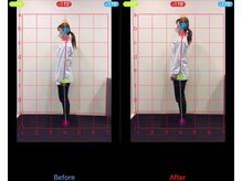 ケアハウス センター南(CARE HOUSE)/施術効果写真☆（before after）