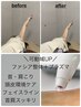 【人気No,1】可動域UP!ファシア整体×プラズマ肌管理