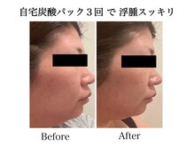 ナチュラーレ 天王寺店(Naturale)/美肌ニキビケア小顔フェイシャル