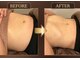 エーシーサロン 六本木店(acsalon)の写真