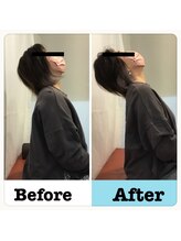 フォーユー鍼灸整骨院 津久野院(for you 鍼灸整骨院)/首と背中の痛みの変化！