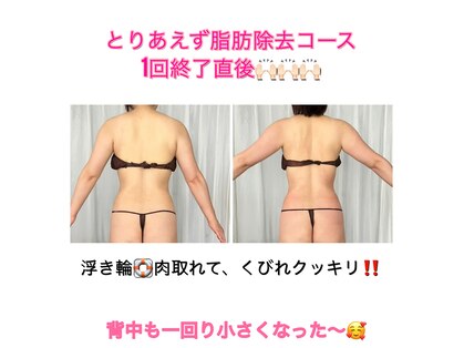 シュシュ エステティックアンドヨガ(chouchou esthetique&yoga)の写真