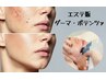 【肌が変わる第一歩・肌悩み全般】高濃度ヒト幹細胞培養液導入！¥7,980