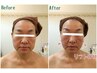 【50代からのエイジングケア】小顔リフトアップフェイシャル9,680→¥8,800