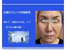 最先端美容★幹細胞上清液×乳酸ピーリング90分¥27000→¥20900