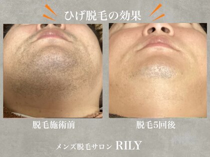 リリー(RILY)の写真