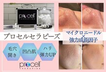 ミレット(Miretto)