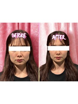 ブライダルメニューがあるサロン