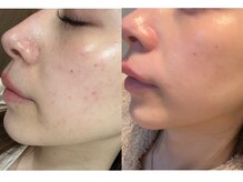 セルヴィノバ(CELL VI NOVA)の雰囲気（元汚肌エステシャン／スキンケアアドバイザー汚肌卒業への近道♪）