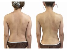 リムアール(Limh R)/