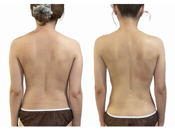 リムアール(Limh R)/