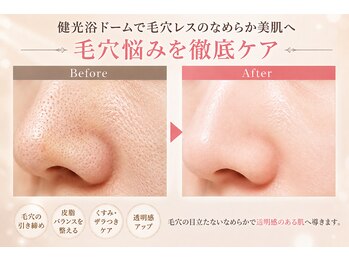 トータルヘルスビューティーカズ(TotalHealthBeauty KAZU)の写真/新感覚の温活美容で毛穴や黒ずみを徹底ケア!15分寝るだけの浴びるエステでお肌の内側から透明感のある肌へ