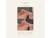 ア ポア(a pois)の雰囲気（ダウンタイムなし◎都内希少の【水光JetPeel】）
