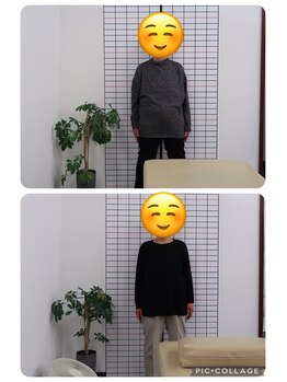 ことぶき整骨院/姿勢改善