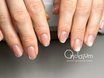 オンシジューム(Oncidium)/ぷるぷるワンカラーネイル♪