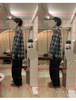 ロアー 赤坂店(RAWR)/巻き肩改善で楽な身体に