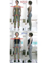 姫路なごみ整体院 なごみ鍼灸院/(改善例)腰痛と肩頃・手首の痛み