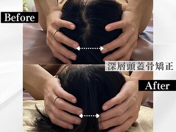 ポーベルポー(Peau Belle poe)/【自律神経整う】深層頭蓋骨矯正