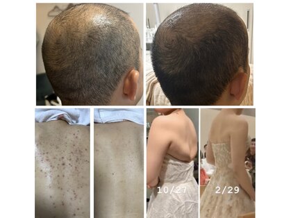 オアジスパ(Oasi Spa)の写真