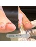 【巻き爪+足トラブル】巻き爪プレート矯正親指２本+爪ケア+角質　￥8800