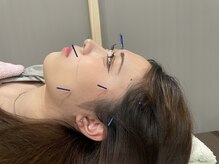 ナノフェイス 名古屋駅前店(nano face)