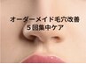 6月【先着3名】再生型毛穴ケア|5回コース¥80,000→¥64,000
