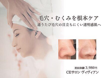 ヴィヴィアンの写真