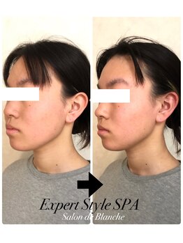 サロン ド ブランシェ(Salon de Blanche)/リフトアップと小顔のヘッドスパ