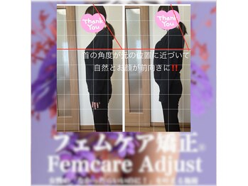 ムーナボーテ(Moona Beaute)