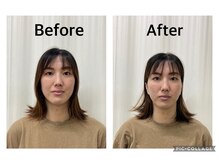 まごころ整骨院/美容鍼Before&After（1回施術）