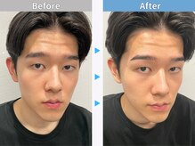 マユクリア 錦糸町店/美眉B/A【眉毛/眉毛サロン】