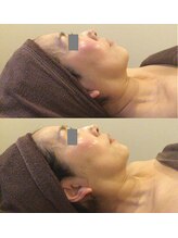 リンク 錦糸町店(Link)/BHF×1回（49歳）