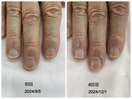 自爪育成